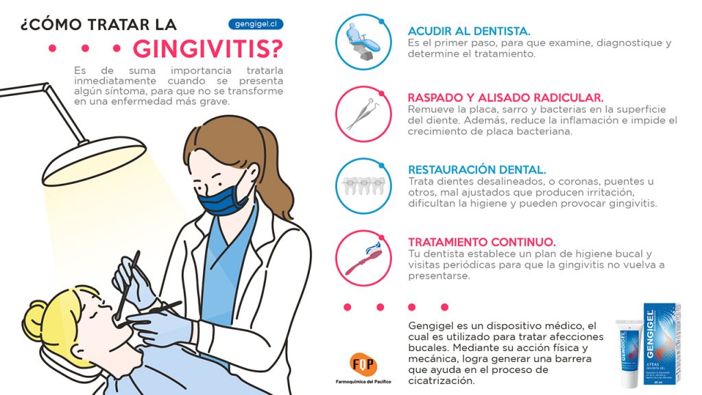 como tratar la gingivitis infografia