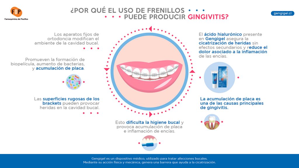 uso de frenillos y gingivitis infografia